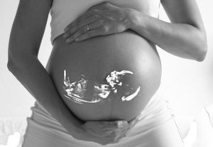 Mujer embarazada eco